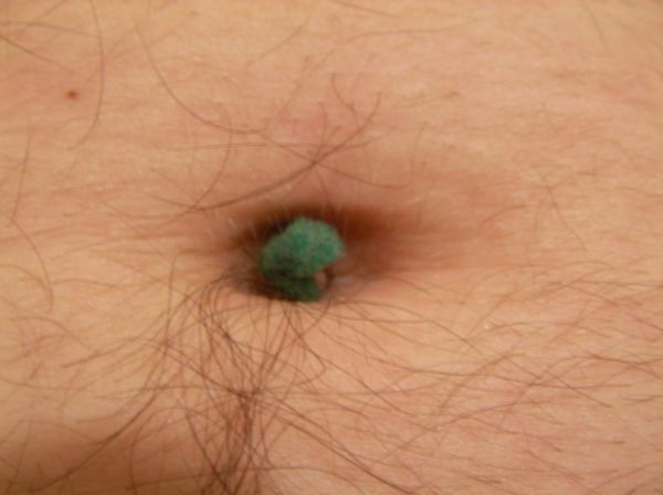 lint