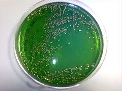 uu vibrio parahaemolyticus tcbs